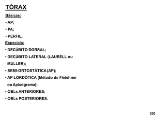 TÓRAX
Básicas:
• AP;
• PA;
• PERFIL.
Especiais:
• DECÚBITO DORSAL;
• DECÚBITO LATERAL (LAURELL ou
MULLER);
• SEMI-ORTOSTÁTICA (AP);
• AP LORDÓTICA (Método de Fleishner
ou Apicograma);
• OBLs ANTERIORES;
• OBLs POSTERIORES.
300
 