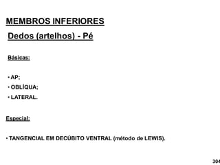 MEMBROS INFERIORES
Dedos (artelhos) - Pé
Básicas:
• AP;
• OBLÍQUA;
• LATERAL.
Especial:
• TANGENCIAL EM DECÚBITO VENTRAL (método de LEWIS).
304
 