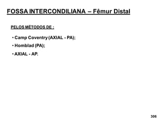 306
FOSSA INTERCONDILIANA – Fêmur Distal
PELOS MÉTODOS DE :
• Camp Coventry(AXIAL - PA);
• Homblad (PA);
• AXIAL - AP.
 