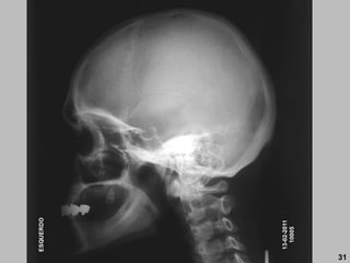 13-02-2011
10005
ESQUERDO
31
 