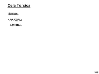 318
Cela Túrcica
Básicas:
• AP AXIAL;
• LATERAL.
 