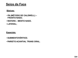 324
Seios da Face
Básicas:
• PA (MÉTODO DE CALDWELL) –
FRONTO NASO;
• LATERAL;
• WATERS – MENTO NASO.
Especiais:
• SUBMENTOVÉRTICE;
• PARIETO ACANTIAL TRANS ORAL.
 
