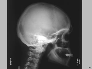 13-02-2011
10005
DIREITO
33
 