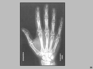 13-02-2011
10005
ESQUERDA
35
 