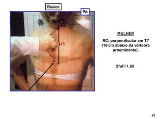 18
MULHER
RC: perpendicular em T7
(18 cm abaixo da vértebra
proeminente).
DfoFi 1.80
PA
41
Básica
 