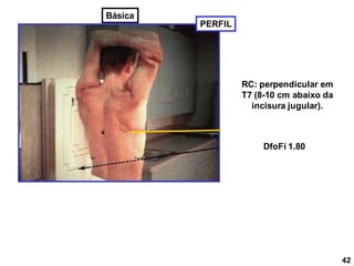 RC: perpendicular em
T7 (8-10 cm abaixo da
incisura jugular).
PERFIL
DfoFi 1.80
42
Básica
 