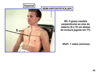 SEMI-ORTOSTÁTICA(AP)
RC: 5 graus caudais
perpendicular ao eixo do
esterno (8 a 10 cm abaixo
da incisura jugular em T7).
DfoFi 1 metro (mínimo).
45
Especial
5 graus
 