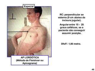 46
AP LORDÓTICA
(Método de Fleishner ou
Apicograma)
RC: perpendicular ao
esterno (9 cm abaixo da
incisura jugular).
Angular entre 15 - 20
graus cefálicos, se o
paciente não conseguir
assumir posição.
DfoFi 1,80 metro.
Especial
 