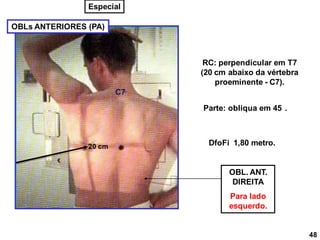 OBLs ANTERIORES (PA)
RC: perpendicular em T7
(20 cm abaixo da vértebra
proeminente - C7).
DfoFi 1,80 metro.
C7
Parte: obliqua em 45 .
OBL. ANT.
DIREITA
Para lado
esquerdo.
48
Especial
20 cm
 