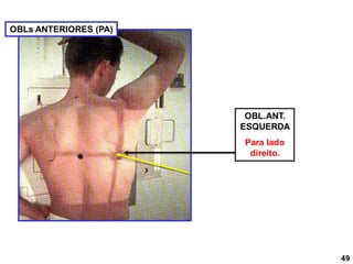 OBL.ANT.
ESQUERDA
Para lado
direito.
OBLs ANTERIORES (PA)
49
 