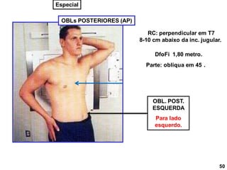 OBL. POST.
ESQUERDA
Para lado
esquerdo.
OBLs POSTERIORES (AP)
RC: perpendicular em T7
8-10 cm abaixo da inc. jugular.
DfoFi 1,80 metro.
Parte: obliqua em 45 .
50
Especial
 