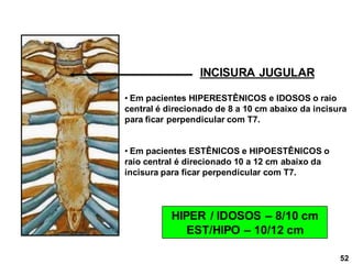 52
INCISURA JUGULAR
• Em pacientes HIPERESTÊNICOS e IDOSOS o raio
central é direcionado de 8 a 10 cm abaixo da incisura
para ficar perpendicular com T7.
• Em pacientes ESTÊNICOS e HIPOESTÊNICOS o
raio central é direcionado 10 a 12 cm abaixo da
incisura para ficar perpendicular com T7.
HIPER / IDOSOS – 8/10 cm
EST/HIPO – 10/12 cm
 
