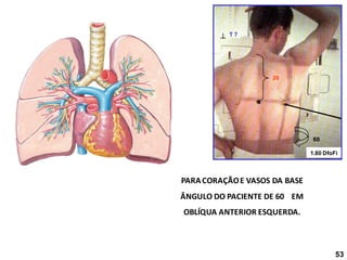 60
PARACORAÇÃOE VASOS DA BASE
ÂNGULO DO PACIENTE DE 60 EM
OBLÍQUA ANTERIOR ESQUERDA.
1.80 DfoFi
 T 7
20
53
 