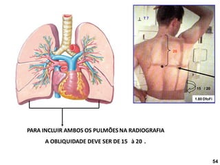 15 / 20
PARA INCLUIR AMBOS OS PULMÕES NA RADIOGRAFIA
A OBLIQUIDADE DEVE SER DE 15 à 20 .
1.80 DfoFi
 T 7
20
54
 