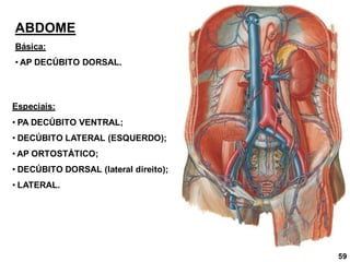 ABDOME
Básica:
• AP DECÚBITO DORSAL.
Especiais:
• PA DECÚBITO VENTRAL;
• DECÚBITO LATERAL (ESQUERDO);
• AP ORTOSTÁTICO;
• DECÚBITO DORSAL (lateral direito);
• LATERAL.
59
 