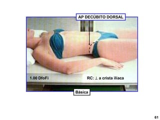 1.00 DfoFi RC:  a crista ilíaca
AP DECÚBITO DORSAL
Básica
61
 