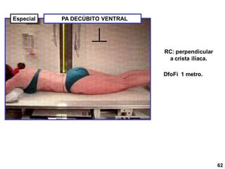 PA DECÚBITO VENTRAL
RC: perpendicular
a crista ilíaca.
DfoFi 1 metro.
62
Especial
 
