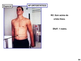AP ORTOSTÁTICO
RC: 5cm acima da
crista ilíaca.
DfoFi 1 metro.
64
Especial
 