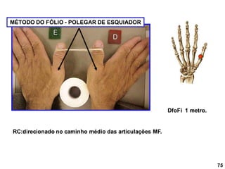 75
MÉTODO DO FÓLIO - POLEGAR DE ESQUIADOR
RC:direcionado no caminho médio das articulações MF.
DfoFi 1 metro.
 