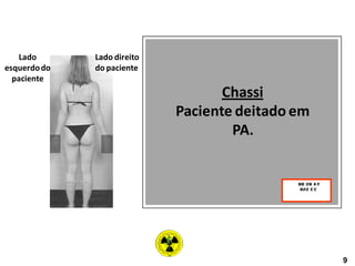 Chassi
Paciente deitado em
PA.
Lado direito
do paciente
Lado
esquerdodo
paciente
9
 