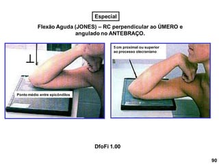 Flexão Aguda (JONES) – RC perpendicular ao ÚMERO e
angulado no ANTEBRAÇO.

Ponto médio entre epicôndilos
5 cm proximal ou superior
ao processo olecraniano
90
DfoFi 1.00
Especial
 