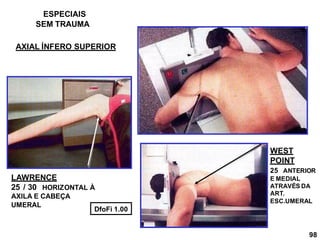 LAWRENCE
25 / 30 HORIZONTAL À
AXILA E CABEÇA
UMERAL
WEST
POINT
25 ANTERIOR
E MEDIAL
ATRAVÉS DA
ART.
ESC.UMERAL
DfoFi 1.00
ESPECIAIS
98
AXIAL ÍNFERO SUPERIOR
SEM TRAUMA
 