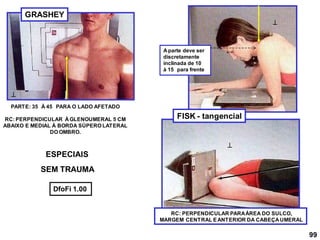 GRASHEY
FISK - tangencial

PARTE: 35 À 45 PARA O LADO AFETADO
RC: PERPENDICULAR À GLENOUMERAL 5 CM
ABAIXO E MEDIAL À BORDA SÚPERO LATERAL
DO OMBRO.
RC: PERPENDICULAR PARAÁREA DO SULCO,
MARGEM CENTRAL EANTERIOR DA CABEÇA UMERAL


DfoFi 1.00
A parte deve ser
discretamente
inclinada de 10
à 15 para frente
99
SEM TRAUMA
ESPECIAIS
 