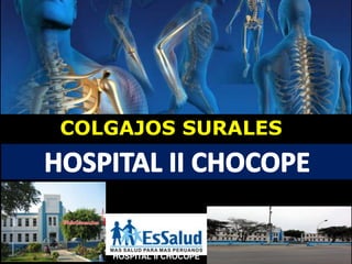 HOSPITAL II CHOCOPE
COLGAJOS SURALES
ELMER JESUS NARVAEZ RODRIGUEZ
MR2 TRAUMATOLOGIA Y ORTOPEDIA
 