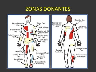 ZONAS DONANTES 