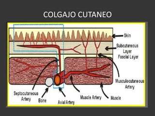COLGAJO CUTANEO 