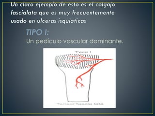 TIPO I:
Un pedículo vascular dominante.
 