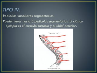 TIPO IV:
Pedículos vasculares segmentarios.
Pueden tener hasta 5 pediculos segmentarios. El clásico
ejemplo es el musculo sartorio y el tibial anterior.
 