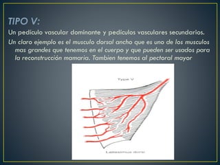 TIPO V:
Un pedículo vascular dominante y pedículos vasculares secundarios.
Un claro ejemplo es el musculo dorsal ancho que es uno de los musculos
mas grandes que tenemos en el cuerpo y que pueden ser usados para
la reconstrucción mamaria. Tambien tenemos al pectoral mayor
 
