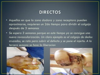 • Aquellos en que la zona dadora y zona receptora pueden
aproximarse, requieren un 2do tiempo para dividir el colgajo
después de 3 semanas
• Se espera 3 semanas porque en este tiempo ya se consigue una
nueva revascularización. Un claro ejemplo es el colgajo de dedos
cruzados, se rota para cubrir el defecto y se pone el injerto. A la
tercera semana se hace la liberacion
 