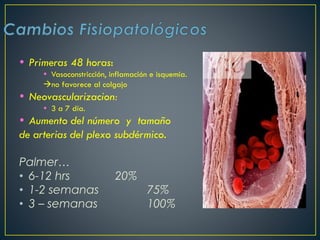  Primeras 48 horas:
 Vasoconstricción, inflamación e isquemia.
no favorece al colgajo
 Neovascularizacion:
 3 a 7 día.
 Aumento del número y tamaño
de arterias del plexo subdérmico.
Palmer…
• 6-12 hrs 20%
• 1-2 semanas 75%
• 3 – semanas 100%
 