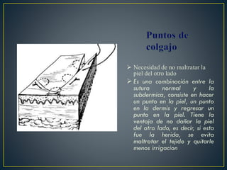  Necesidad de no maltratar la
piel del otro lado
 Es una combinación entre la
sutura normal y la
subdermica, consiste en hacer
un punto en la piel, un punto
en la dermis y regresar un
punto en la piel. Tiene la
ventaja de no dañar la piel
del otro lado, es decir, si esta
fue la herida, se evita
maltratar el tejido y quitarle
menos irrigacion
 