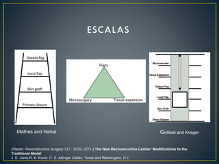 Gottlieb and Krieger
Mathes and Nahai
(Plastic. Reconstructive Surgery 127 : 205S, 2011.) The New Reconstructive Ladder: Modifications to the
Traditional Model
J. E. Janis,R. K. Kwon, C. E. Attinger Dallas, Texas and Washington, D.C.
 
