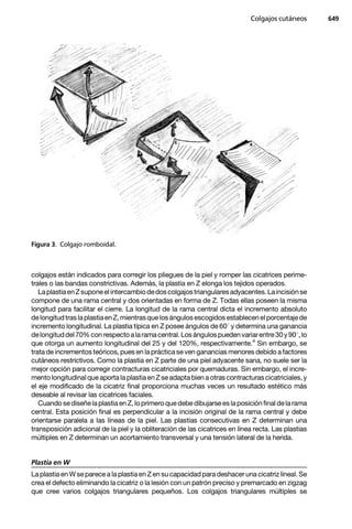 Colgajos cutáneos       649




Figura 3. Colgajo romboidal.



colgajos están indicados para corregir los pliegues de la piel y romper las cicatrices perime-
trales o las bandas constrictivas. Además, la plastia en Z elonga los tejidos operados.
   La plastia en Z supone el intercambio de dos colgajos triangulares adyacentes. La incisión se
compone de una rama central y dos orientadas en forma de Z. Todas ellas poseen la misma
longitud para facilitar el cierre. La longitud de la rama central dicta el incremento absoluto
de longitud tras la plastia en Z, mientras que los ángulos escogidos establecen el porcentaje de
incremento longitudinal. La plastia típica en Z posee ángulos de 601 y determina una ganancia
de longitud del 70% con respecto a la rama central. Los ángulos pueden variar entre 30 y 901, lo
que otorga un aumento longitudinal del 25 y del 120%, respectivamente.4 Sin embargo, se
trata de incrementos teóricos, pues en la práctica se ven ganancias menores debido a factores
cutáneos restrictivos. Como la plastia en Z parte de una piel adyacente sana, no suele ser la
mejor opción para corregir contracturas cicatriciales por quemaduras. Sin embargo, el incre-
mento longitudinal que aporta la plastia en Z se adapta bien a otras contracturas cicatriciales, y
el eje modificado de la cicatriz final proporciona muchas veces un resultado estético más
deseable al revisar las cicatrices faciales.
   Cuando se diseñe la plastia en Z, lo primero que debe dibujarse es la posición final de la rama
central. Esta posición final es perpendicular a la incisión original de la rama central y debe
orientarse paralela a las líneas de la piel. Las plastias consecutivas en Z determinan una
transposición adicional de la piel y la obliteración de las cicatrices en línea recta. Las plastias
múltiples en Z determinan un acortamiento transversal y una tensión lateral de la herida.


Plastia en W
La plastia en W se parece a la plastia en Z en su capacidad para deshacer una cicatriz lineal. Se
crea el defecto eliminando la cicatriz o la lesión con un patrón preciso y premarcado en zigzag
que cree varios colgajos triangulares pequeños. Los colgajos triangulares múltiples se
 