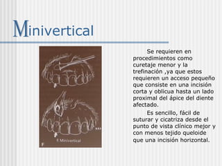 inivertical
Se requieren en
procedimientos como
curetaje menor y la
trefinación ,ya que estos
requieren un acceso pequeño
que consiste en una incisión
corta y oblicua hasta un lado
proximal del ápice del diente
afectado.
Es sencillo, fácil de
suturar y cicatriza desde el
punto de vista clínico mejor y
con menos tejido queloide
que una incisión horizontal.
 