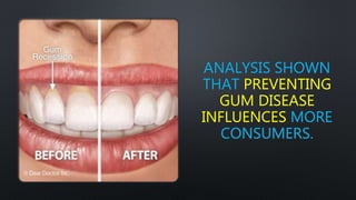 ANALYSIS SHOWN
THAT PREVENTING
GUM DISEASE
INFLUENCES MORE
CONSUMERS.
 