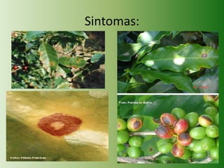 Sintomas:

 