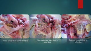 Clear airsac of an uninfected bird Foamy exudate seen early in
infection
Caseous exudate later in
infection
 