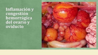 Inflamación y
congestión
hemorrágica
del ovario y
oviducto
 