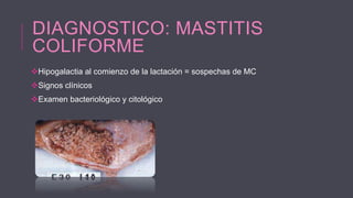 DIAGNOSTICO: MASTITIS
COLIFORME
Hipogalactia al comienzo de la lactación = sospechas de MC
Signos clínicos
Examen bacteriológico y citológico

 