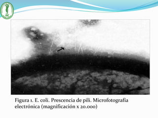 Figura 1. E. coli. Prescencia de pili. Microfotografía
electrónica (magnificación x 20.000)
 