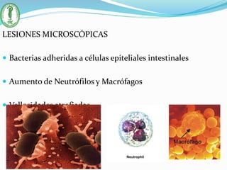 LESIONES MICROSCÓPICAS
 Bacterias adheridas a células epiteliales intestinales
 Aumento de Neutrófilos y Macrófagos
 Vellosidades atrofiadas
 