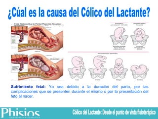 ¿Cúal es la causa del Cólico del Lactante? Sufrimiento fetal:  Ya sea debido a la duración del parto, por las complicaciones que se presenten durante el mismo o por la presentación del feto al nacer.   Cólico del Lactante: Desde el punto de vista fisioterápico 