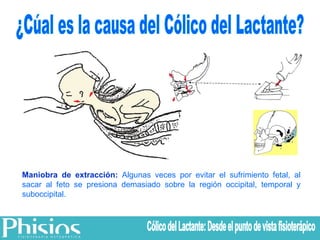 ¿Cúal es la causa del Cólico del Lactante? Maniobra de extracción:  Algunas veces por evitar el sufrimiento fetal, al sacar al feto se presiona demasiado sobre la región occipital, temporal y suboccipital. Cólico del Lactante: Desde el punto de vista fisioterápico 