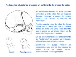 Todas estas situaciones provocan un sufrimiento del cráneo del bebé. En un bebé los huesos no están del todo formados, y entre ellos hay un espacio llamado “suturas” y zonas de mayor tamaño que reciben el nombre de “fontanela” Podéis apreciar una de ellas de forma simple en la parte alta de la cabeza donde se nota una zona más blandita que a veces os da miedo tocar, es la fontanela bregmática o anterior. En los casos mencionados anteriormente las “fontanelas” se pueden ver irritadas, inflamadas e incluso comprimidas.  Igualmente se puede producir tal compresión que uno de los huesos se monta sobre su hueso vecino, provocando un “acabalgamiento” Normal Acabalgamiento 