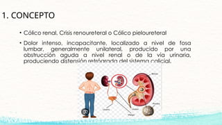 Colico nefritico nefrologia medicina ucs | PPTX